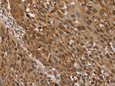 STMN2/STMN3/STMN4 Antibody