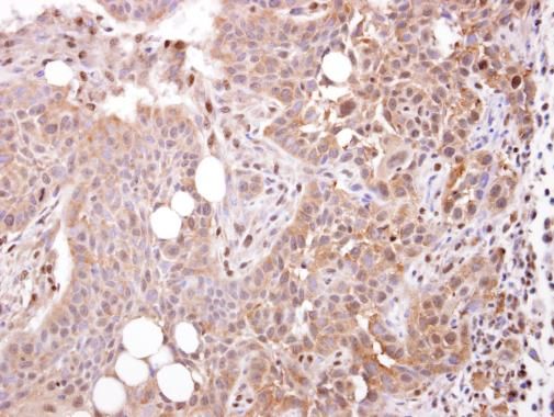 STOML1 antibody [N2C3]