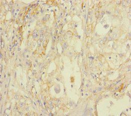 STOML2 Antibody