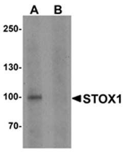 STOX1 Antibody