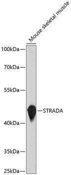 STRADA antibody