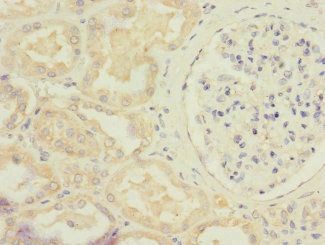 STRADA Antibody