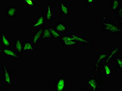 STRBP Antibody