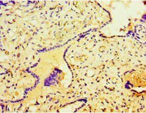 STRN antibody