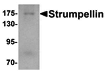 Strumpellin Antibody