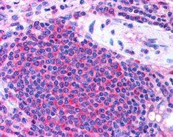 Goat anti-STS2 / TULA (internal) Antibody