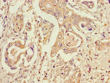 STT3A Antibody