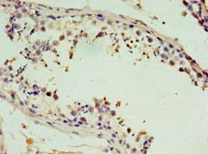 STX11 antibody