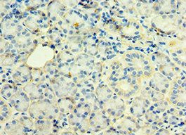 STX12 Antibody