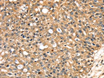 STX18 Antibody