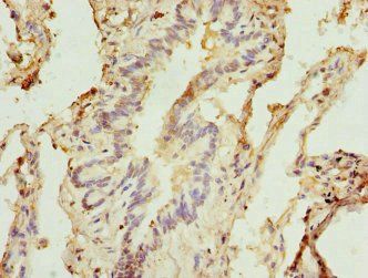 STX5 Antibody