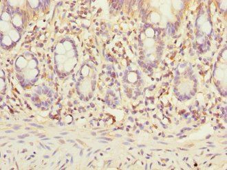 STX7 Antibody