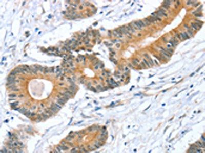 STXBP1 Antibody