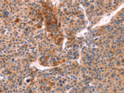 STXBP2 antibody