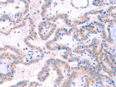 STXBP2 Antibody