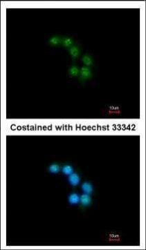 STXBP2 antibody