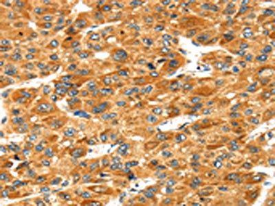 STXBP4 Antibody