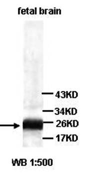 STXBP6 Rabbit Polyclonal Antibody