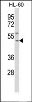 TACR1 antibody (Center)