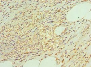 Substance P antibody