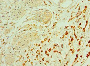 TAC1 Antibody