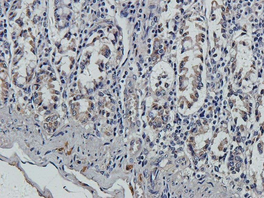 Substance P Rabbit Polyclonal Antibody