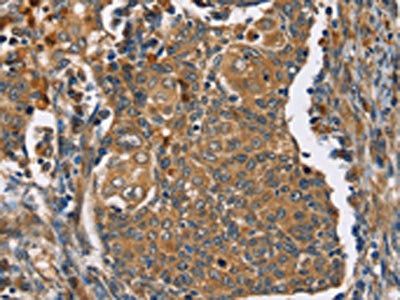 TAC1 Antibody
