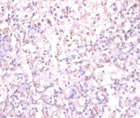 TACR1 Antibody