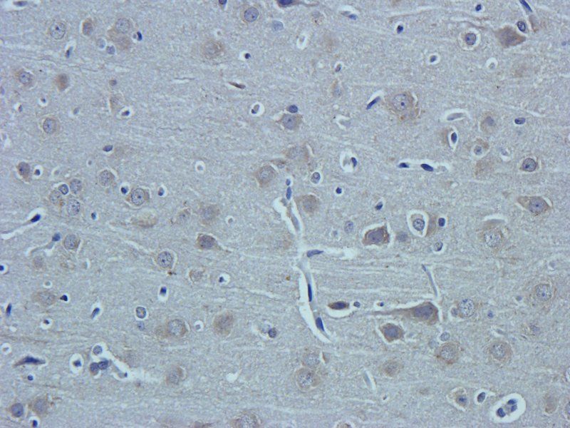 Substance P Rabbit Polyclonal Antibody
