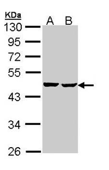 succinate-CoA ligase, ADP-forming, beta subunit precursor antibody
