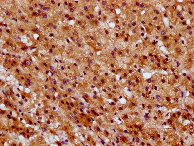 SUCLG1 antibody