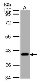 SUCLG1 antibody