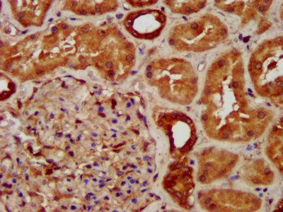 SUCLG2 Antibody