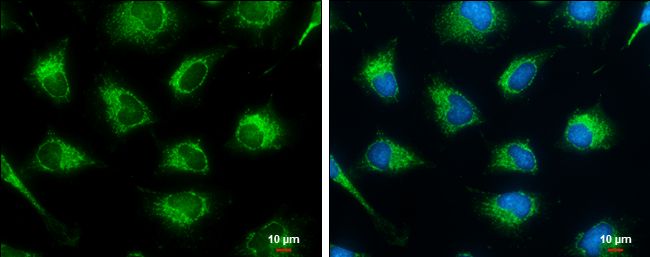 succinate-CoA ligase GDP-forming beta subunit Antibody