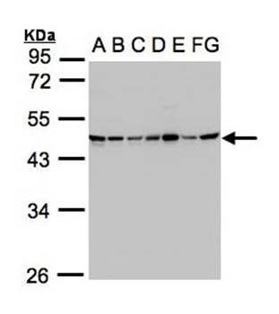 succinate-CoA ligase, GDP-forming beta subunit precursor antibody