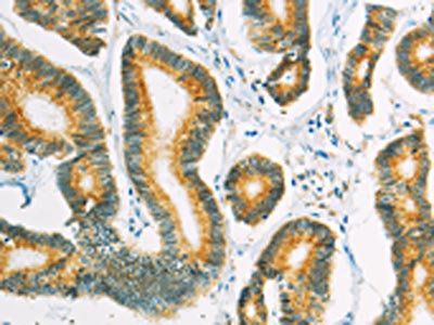 SUFU Antibody