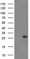 SULT1A1 Antibody