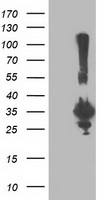 SULT1A1 Antibody