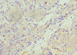 SULT1A1 Antibody