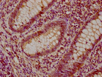 SULT1A2 Antibody