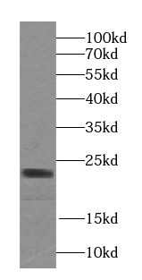 SULT1A4 antibody