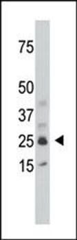 SULT1C1 antibody