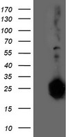 SULT1C2 antibody