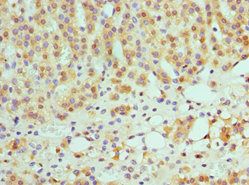 SULT2A1 Antibody
