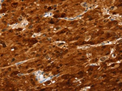 SULT2A1 Antibody