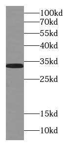 SULT4A1 antibody