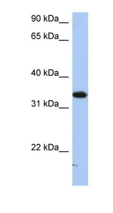 SULT6B1 antibody