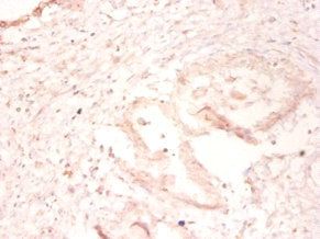 UBE2I Antibody