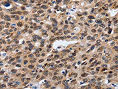 SUMO1 Antibody