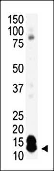 SUMO1 antibody